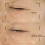 Revitalizing Supreme+ Night Power Bounce Creme Moisturizer